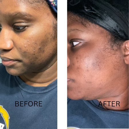 Purifying Facial Cleanser